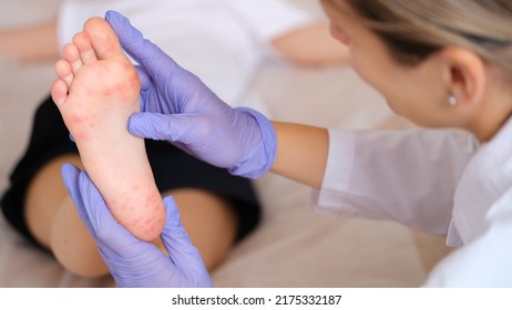 Doctor examining foot of child with red itchy rashes in clinic closeup - Shutterstock ID 2175332187