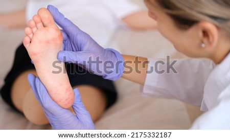 Doctor examining foot of child with red itchy rashes in clinic closeup