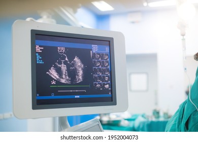 Doctor is examining heart's patient by echocardiogram for diagnosis disease or explain symptom. Medical exam , ultrasound. Medical equipment.