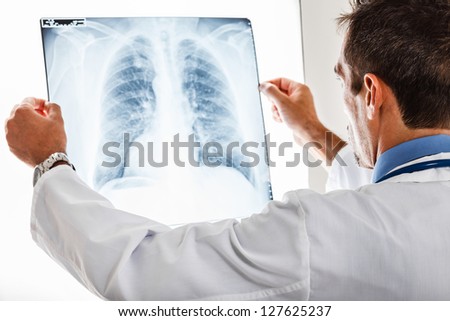 Doctor examining a lung radiography
