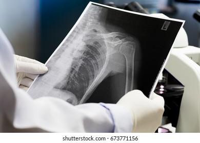 Doctor Examining Lung Radiography Doctor Looking Stock Photo 673771156 ...