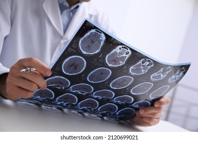 Doctor examining MRI images of patient with multiple sclerosis at table in clinic, closeup