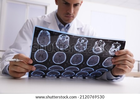 Doctor examining MRI images of patient with multiple sclerosis at table in clinic, closeup