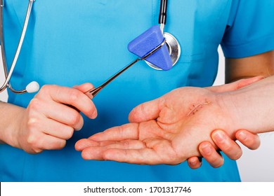 Doctor Examining Nerve Conduction On Palm Of Hand After Carpal Tunnel Syndrome