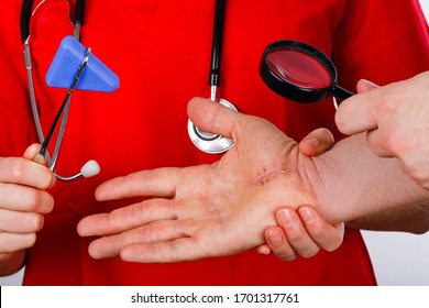 Doctor Examining Nerve Conduction On Palm Of Hand After Carpal Tunnel Syndrome