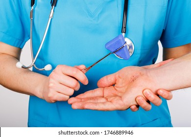 Doctor Examining Nerve Conduction On Palm Of Hand After Carpal Tunnel Syndrome