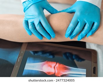 Doctor Examining Patients Knee With X-Ray Image - Powered by Shutterstock