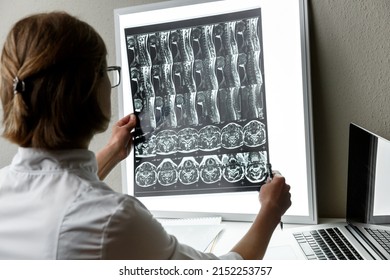 Doctor Examining The Result Of Cervical Spine MRI.  Health Care And Medical Insurance Concept