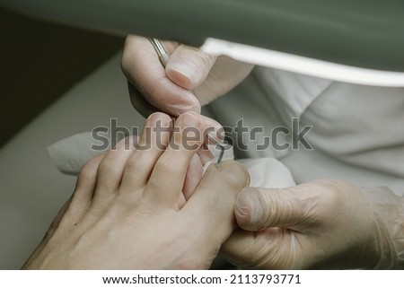 doctor examining sore toenails of a man