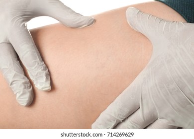 Doctor Examining Woman's Leg For Varicosis, Closeup