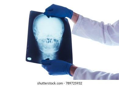 Doctor Examining Xray Patients Skull Medical Stock Photo 1008172495 ...