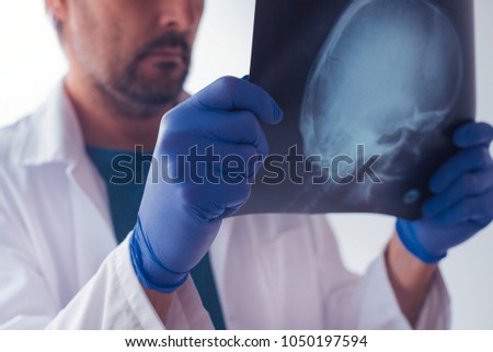 Doctor examining x-ray of the patient's skull in a medical clinic. Healthcare professional analyzing imaging test of human head.