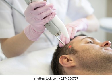 Doctor Female Dermatologist Trichologist Makes A Procedure To Stimulate Hair Growth To A Patient Man. Laser Treatment Of Alopecia And Hair Loss.  Close Up .