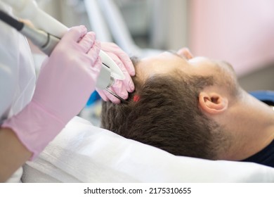 Doctor female dermatologist trichologist makes a procedure to stimulate hair growth to a patient man. Laser treatment of alopecia and hair loss - Shutterstock ID 2175310655