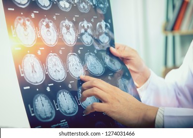 Arzt berät Patienten über MRI (Röntgenuntersuchung)-Hirnuntersuchungen 