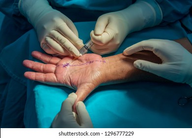 Doctor giving the injection to the patient 's hand. The digital nerve block perform to relieve pain before trigger finger release surgery. Close up photo with dark background. Medical concept. 