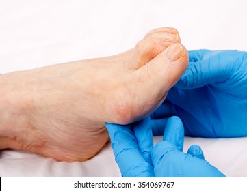 Doctor hand examining an elderly patient's foot