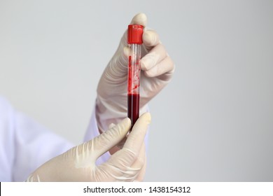 Doctor Hand Holding Blood Collection Tubes In Hematology Laboratory, Medicine And Science Concept