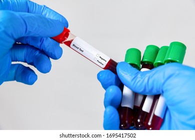 Doctor Hand Holding Blood Tube Test Stock Photo 1695417502 | Shutterstock