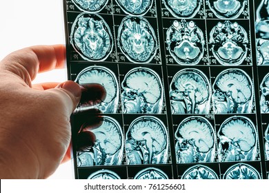 Doctor hand holds MRI brain scan or magnetic resonance image results, neurology concept