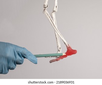 Doctor Hand Pointing To Human Skeleton Foot With Red Point. Heel, Ankle, Forefoot Pain. Injury, Excessive Physical Activity, Ill-fitting Shoes. Skeletal System Anatomy, Medical Education Concept