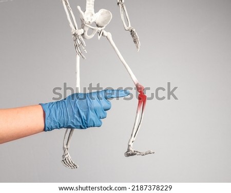 Doctor hand pointing to skeleton knee with red point. Leg pain. Sprained, ruptured ligaments, meniscus tear, tendinitis, arthritis. Skeletal system anatomy, medical education concept. photo