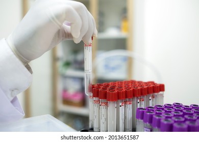 Doctor Hand Or Specialist In Lab Coat Wearing Glove And Holding At Test Tube Sample In The Clinic. There Are Many Tube Sample In The Rack On The Tray. Laboratory, Testing And Lifestyle Concept.