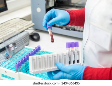 Doctor Hand Taking A Blood Sample Tube From A Rack With Machines Of Analysis In The Lab Background / Technician Holding Blood Tube Test In The Research Laboratory