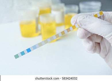 Doctor Hand With Test Strip, Closeup