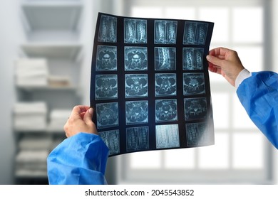 A Doctor Hands Holding And Analyzes Spine Radiography X-ray 