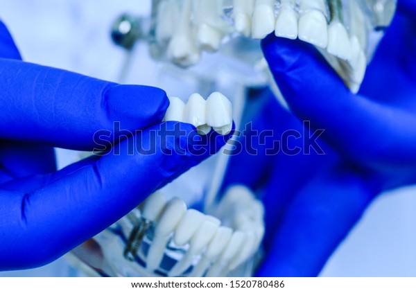 Doctor hands holding teeth model in dental\
clinic. Teeth model held by real dentist with blue gloves. Dentist\
showing a jaw model. Dentistry, dental care, healthy teeth,\
orthodontic, hygiene\
concept.