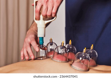 Doctor hands makes vacuum cups on patient back, medical cupping therapy on human body, close up. Medic vacuum cup, health rehabilitation. Wellness, alternative medicine concept. Copy ad text space - Shutterstock ID 2364437041