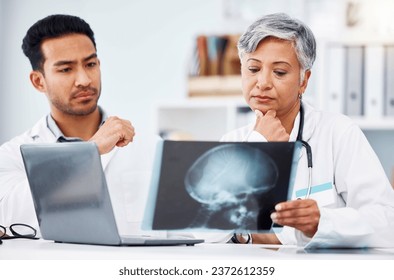 Doctor, healthcare and skull xray analysis, collaboration and laptop with neuro and assessment of scan. Head injury, radiology and people on surgeon team, review picture with anatomy in hospital
