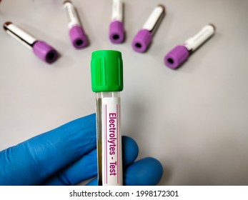 480 Electrolyte Test Images, Stock Photos & Vectors | Shutterstock