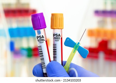 doctor holding Blood tubes and needle for analysis of PSA Free and PSA Total in biochemistry lab. Blood samples for study of PSA Prostate Specific Antigen Free and Total