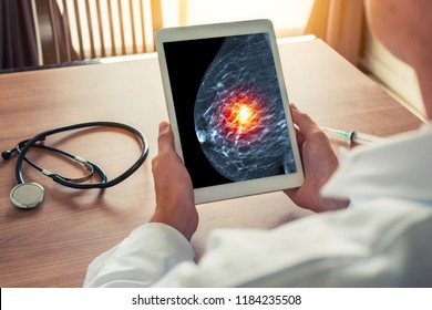 Doctor holding a digital tablet with mammogram skeleton. Breast cancer prevention - Shutterstock ID 1184235508