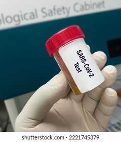 Doctor Holding Fecal Sample For Viral Disease COVID-19 SARS-CoV-2.(previously Known As 2019-nCov).