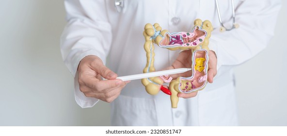 Doctor holding human Colon anatomy model. Colonic disease, Large Intestine, Colorectal cancer, Ulcerative colitis, Diverticulitis, Irritable bowel syndrome, Digestive system and Health concept - Shutterstock ID 2320851747