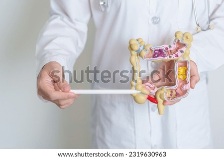 Doctor holding human Colon anatomy model. Colonic disease, Large Intestine, Colorectal cancer, Ulcerative colitis, Diverticulitis, Irritable bowel syndrome, Digestive system and Health concept