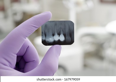 Doctor holding and looking at dental x-ray