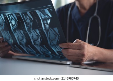 Doctor Holding And Looking Patient Bone X-ray Film Before Surgery. MRI And CT Scan Examining At Radiology Orthopedic Unit In Hospital. Knee Joint X-ray For Treatment