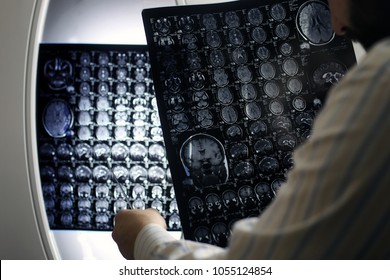 Doctor Holding A Picture Of A Brain MRI Workflow In Diagnostic Hospital