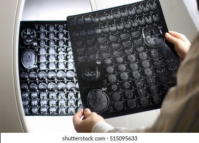 Doctor Holding A Picture Of A Brain MRI Workflow In Diagnostic Hospital