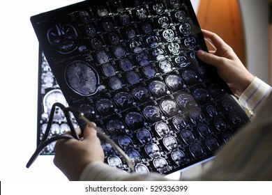 Doctor Holding A Picture Of A Brain MRI Workflow In Diagnostic Hospital