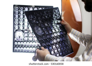 Doctor Holding A Picture Of A Brain MRI Workflow In Diagnostic Hospital