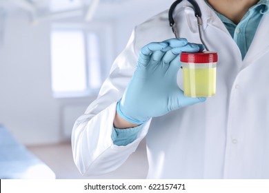 Doctor holding plastic jar with urine, closeup