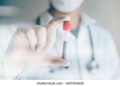 Doctor holding positive Covid-19 test. Coronavius outbreak crisis. Blood sample in a tube at lab.  - Shutterstock ID 1691963620