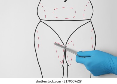 Doctor Holding Scalpel Near Drawn Human Body With Marks On White Background, Top View. Weight Loss Surgery