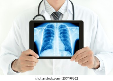 Xray Screen Images Stock Photos Vectors Shutterstock