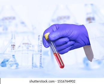 Doctor Holding A Test Tube With Blood In His Hand, Blood Test For Diseases Like Cancer. Concept Of Research For The Treatment Of Deadly Diseases